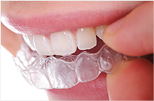 Invisalign Sterling Heights, Michigan