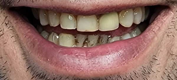 10-before