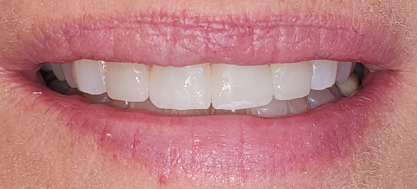 6-after