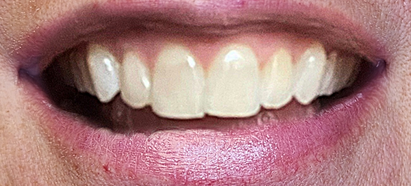 9-before